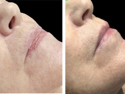 Screenshot 2025-03-04 at 4.35.31 PM